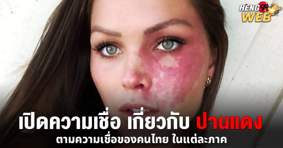 ปานแดงความเชื่อ-"Red-birthmark-beliefs"